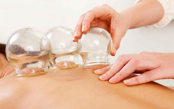 Medical Cupping Therapy
